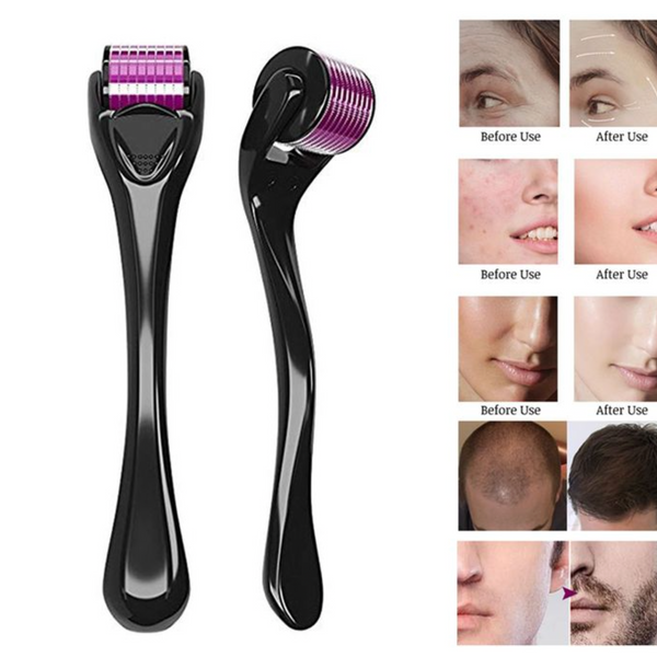 Derma Roller| Micro Needling Treatment