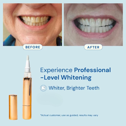 Medipharm™ Pro Gold Whitening Pen