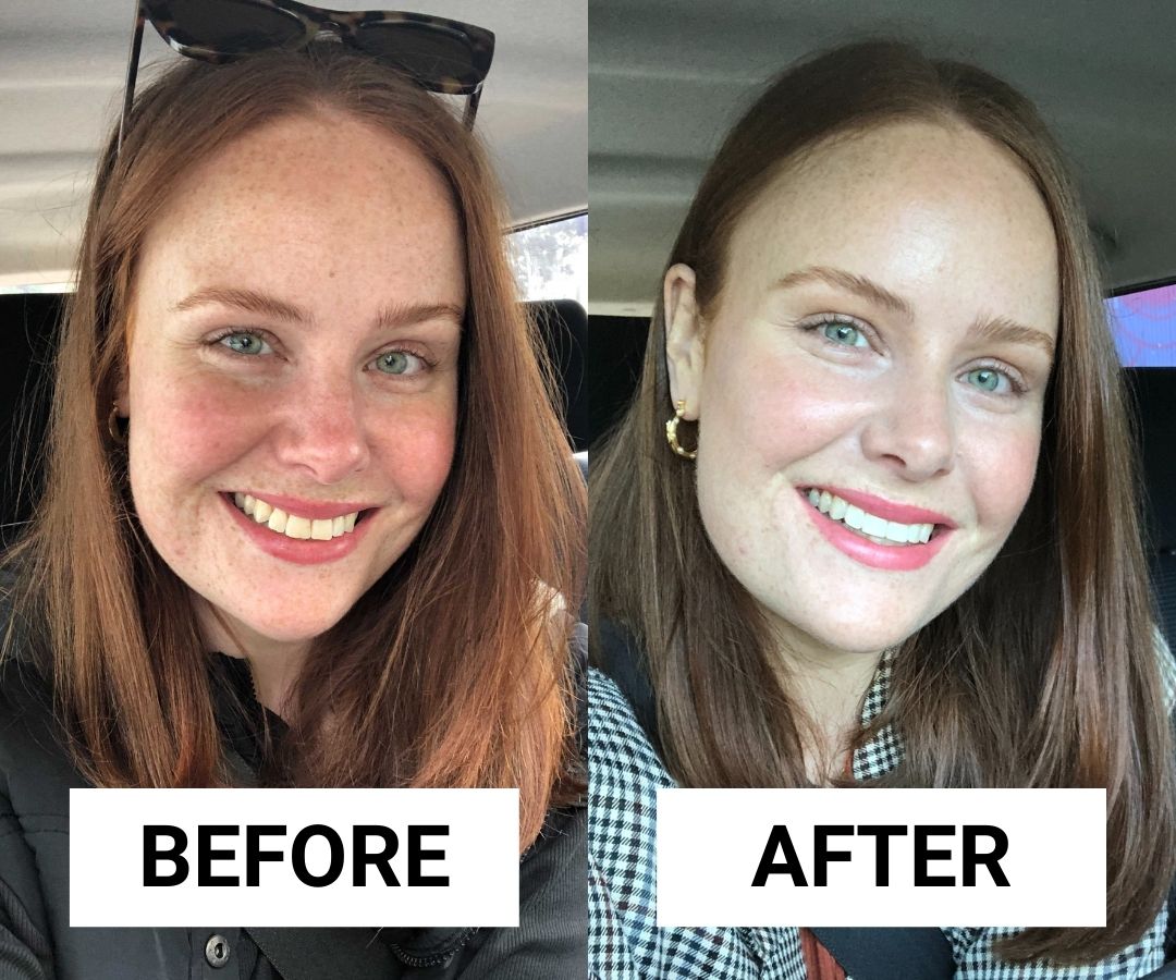 Medipharm™ By Her Extra Snow Whitening Serum
