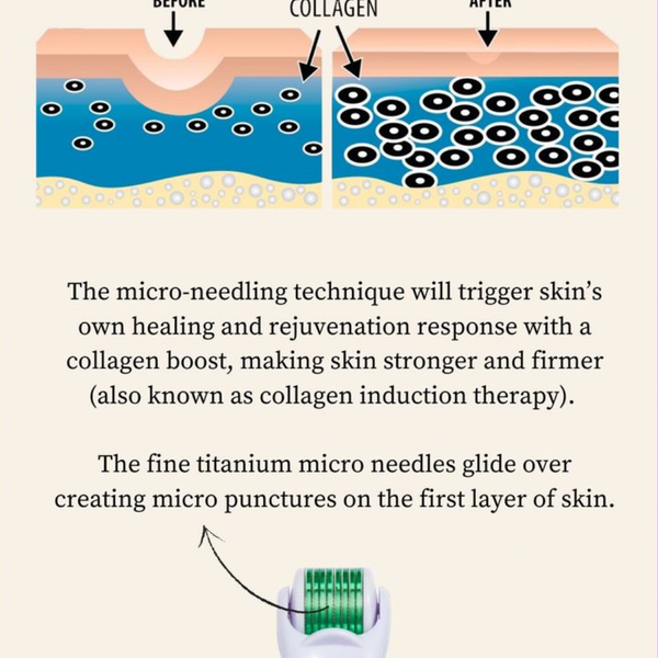 Derma Roller| Micro Needling Treatment