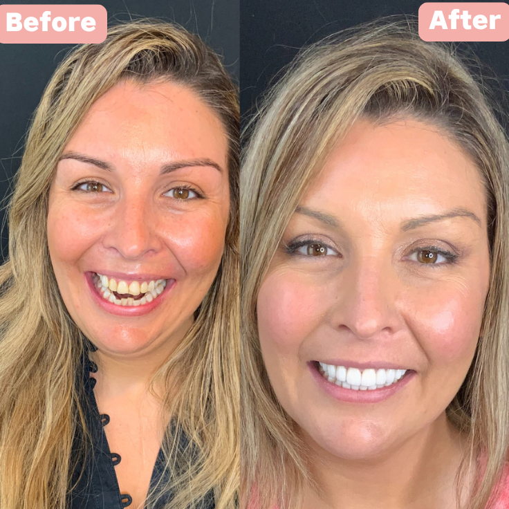 Medipharm™ By Her Extra Snow Whitening Serum