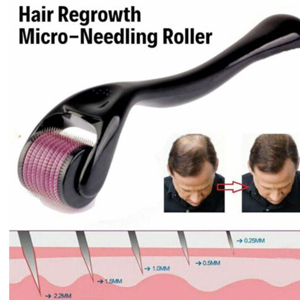 Derma Roller| Micro Needling Treatment