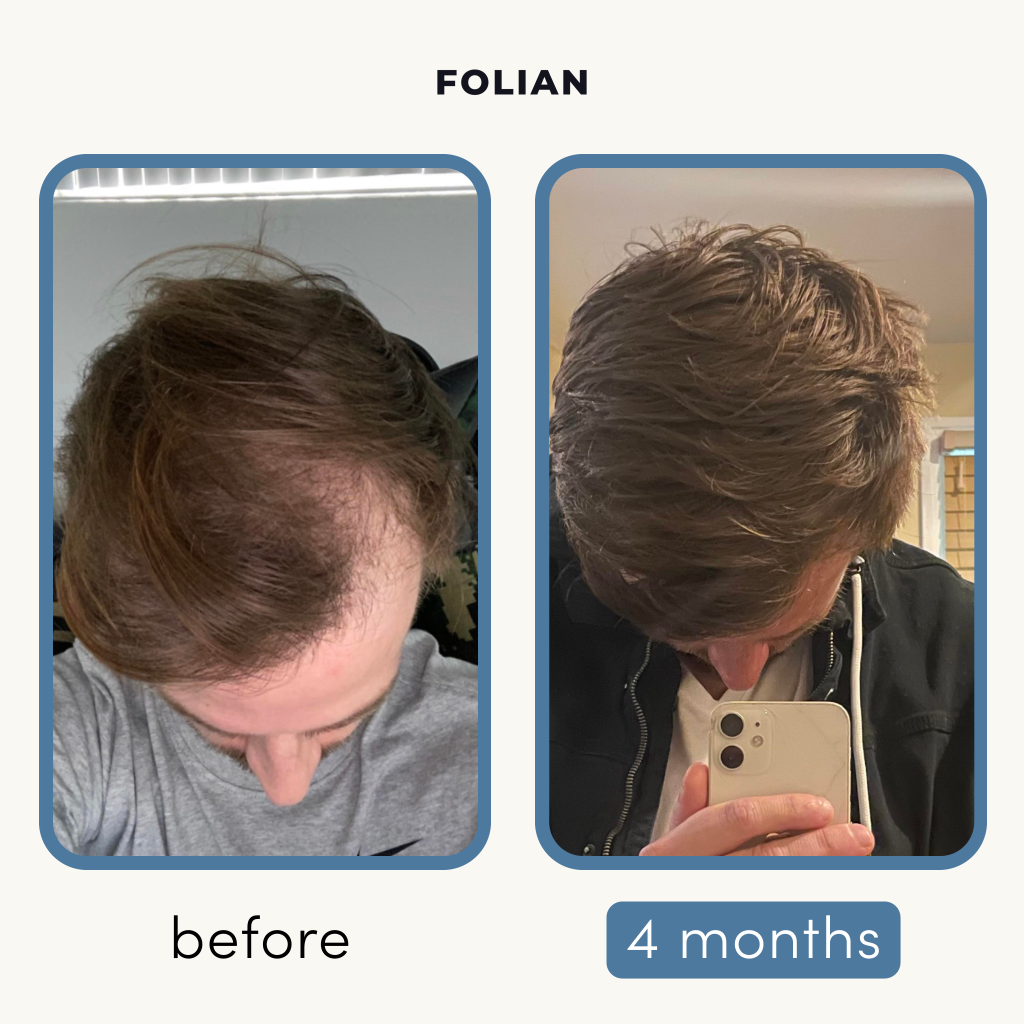 Medipharm™  Hair Revival Serum